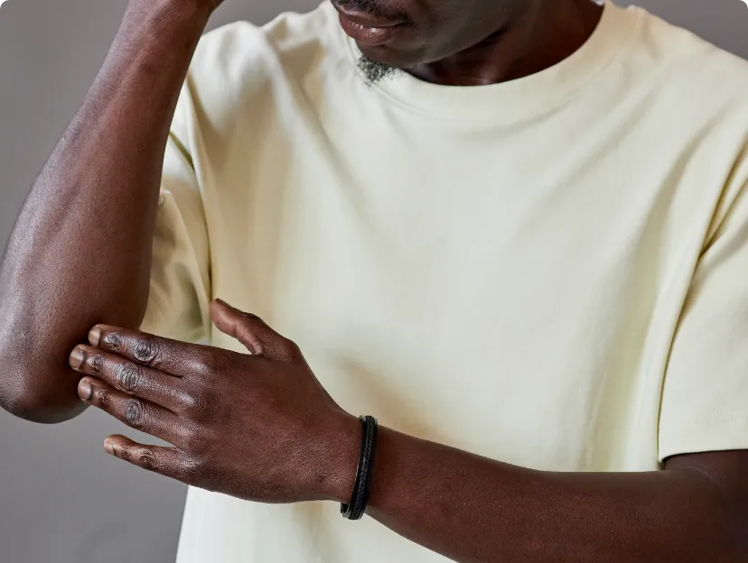 Close-up of a man's neck, revealing redness indicative of eczema, a skin condition