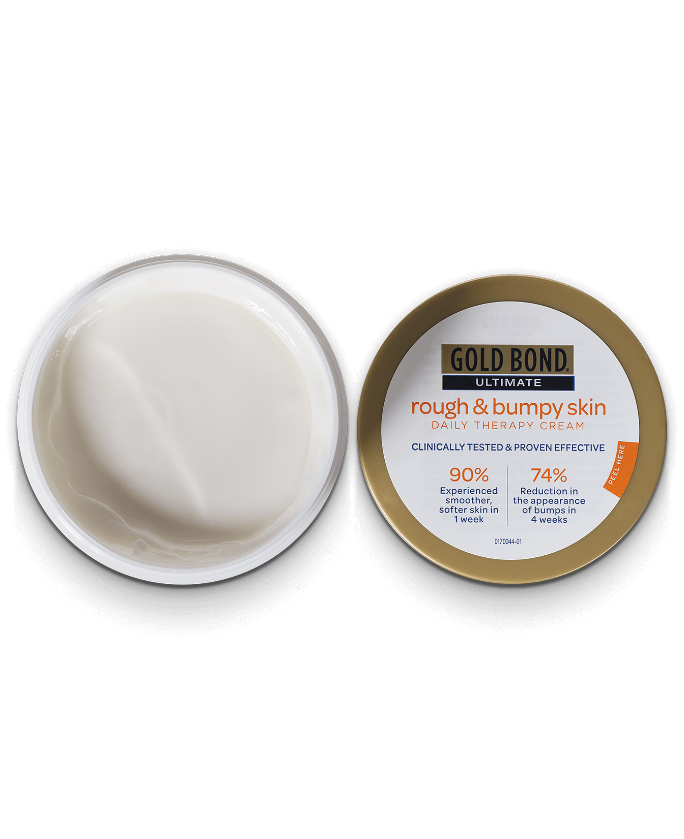Rough & Bumpy Skin Daily Therapy Cream Gold Bond®