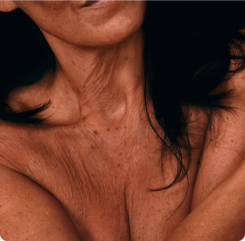 Close-up of a woman's neck featuring natural skin texture and lines. 