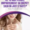 Gold Bond Age Renew Crepe Corrector body Lotion benefits and statements
